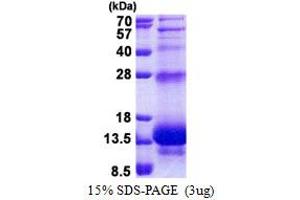 SDS-PAGE (SDS) image for Peptidase Inhibitor 3, Skin-Derived (PI3) (AA 23-117) protein (His tag) (ABIN5778835) (PI3 Protein (AA 23-117) (His tag))
