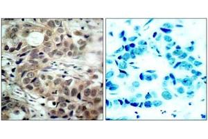 Image no. 1 for anti-Cell Division Cycle 25 Homolog C (S. Pombe) (CDC25C) (pSer216) antibody (ABIN196818) (CDC25C 抗体  (pSer216))