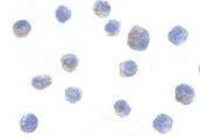 Immunocytochemistry of IKK alpha in Jurkat cells with AP30405PU-N IKK alpha antibody at 10 μg/ml. (IKK alpha 抗体  (C-Term))