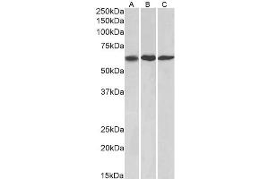 ABIN1590061 (1µg/ml) staining of NIH3T3, (A) A549 (B) and HeLa (C) lysates (35µg protein in RIPA buffer).