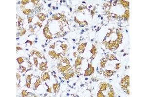 Immunohistochemistry (Paraffin-embedded Sections) (IHC (p)) image for anti-ATP Synthase, H+ Transporting, Mitochondrial F0 Complex, Subunit E (ATP5I) antibody (ABIN7259374)