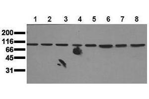 Western Blotting (WB) image for anti-Mitogen-Activated Protein Kinase 7 (MAPK7) (N-Term) antibody (ABIN126797) (MAPK7 抗体  (N-Term))