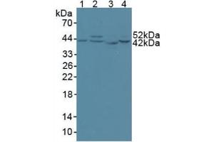 Western blot analysis of (1) Human 293T Cells, (2) Human HeLa cells, (3) Rat Skeletal Muscle Tissue and (4) Human HepG2 Cells. (CS 抗体  (AA 56-312))