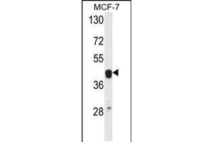 Western blot analysis of ETS2 Antibody in MCF-7 cell line lysates (35ug/lane) (ETS2 抗体  (AA 146-173))