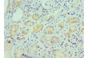 Immunohistochemistry of paraffin-embedded human kidney tissue using ABIN7156941 at dilution of 1:100 (IL-9 抗体  (AA 19-144))