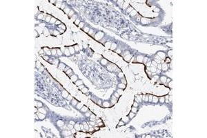 Immunohistochemical staining of human colon with VILL polyclonal antibody  shows strong luminal membrane positivity in glandular cells at 1:50-1:200 dilution. (VILL 抗体)