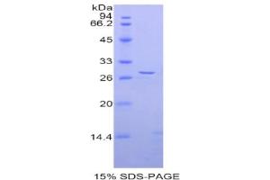 SDS-PAGE analysis of Rat ADAM5 Protein. (ADAM5 蛋白)