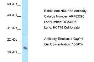 Western Blotting (WB) image for anti-NADH Dehydrogenase (Ubiquinone) 1 beta Subcomplex, 7, 18kDa (NDUFB7) (N-Term) antibody (ABIN2789101) (NDUFB7 抗体  (N-Term))