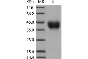 Western Blotting (WB) image for CD200 (CD200) (Active) protein (His tag) (ABIN7320017) (CD200 Protein (CD200) (His tag))