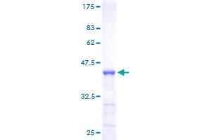 Image no. 1 for Numb Homolog (NUMB) (AA 1-135) protein (GST tag) (ABIN1313212) (NUMB Protein (AA 1-135) (GST tag))