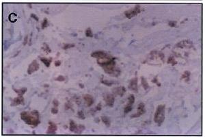 Immunohistochemistry image of dihydropyridine adduct staining in paraffn section of human atherosclerotic aorta. (Malondialdehyde 抗体)