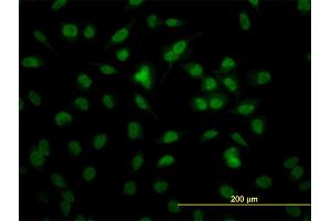 Immunofluorescence of monoclonal antibody to RBBP4 on HeLa cell. (Retinoblastoma Binding Protein 4 抗体  (AA 316-426))