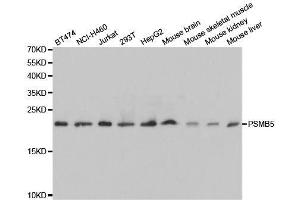 Western blot analysis of extracts of various cell lines, using PSMB5 antibody.