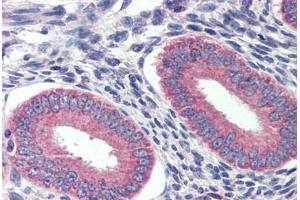 Human Prostate: Formalin-Fixed, Paraffin-Embedded (FFPE) (GRHL2 抗体  (C-Term))