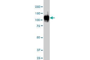 Western Blotting (WB) image for anti-ATPase, Ca++ Transporting, Cardiac Muscle, Fast Twitch 1 (ATP2A1) (AA 522-612) antibody (ABIN559993)