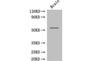 Western Blot Positive WB detected in: Mouse brain tissue All lanes: ASH2L antibody at 3 μg/mL Secondary Goat polyclonal to rabbit IgG at 1/50000 dilution Predicted band size: 69, 57, 61 kDa Observed band size: 69 kDa (ASH2L 抗体  (AA 1-534))