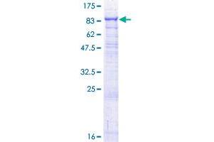 GALC Protein (AA 1-669) (GST tag)