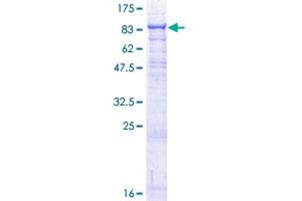 GALC Protein (AA 1-669) (GST tag)