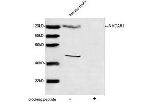Western blot analysis of tissue lysates using NMDAR1 Antibody (ABIN399084, 1 µg/mL) The signal was developed with IRDyeTM 800 Conjugated Goat Anti-Rabbit IgG. (GRIN1/NMDAR1 抗体  (AA 900-950))