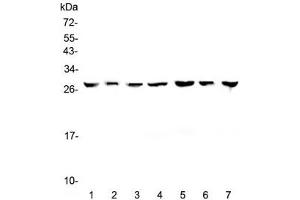 Western blot testing of human 1) HeLa, 2) placenta, 3) HepG2, 4) A549, 5) PANC-1, 6) SK-OV-3 and 7) 22RV1 lysate with 14-3-3 zeta antibody at 0. (14-3-3 zeta 抗体)