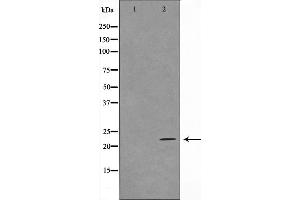 Western blot analysis on HuvEc cell lysate using TFIP8 Antibody,The lane on the left is treated with the antigen-specific peptide. (TNFAIP8 抗体  (Internal Region))