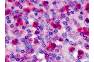 Human Spleen: Formalin-Fixed, Paraffin-Embedded (FFPE) (FPR1 抗体)