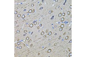 Immunohistochemistry of paraffin-embedded rat brain using MAP1B antibody (ABIN1873595) at dilution of 1:100 (40x lens). (MAP1B 抗体)