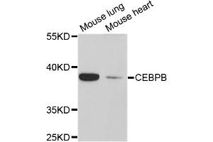 Western blot analysis of extracts of various cell lines, using CEBPB antibody. (CEBPB 抗体)