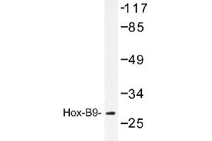 Image no. 1 for anti-Homeobox B9 (HOXB9) antibody (ABIN272173) (HOXB9 抗体)