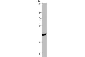 Gel: 8 % SDS-PAGE, Lysate: 40 μg, Lane: Mouse skeletal muscle tissue, Primary antibody: ABIN7191867(PHKG1 Antibody) at dilution 1/200, Secondary antibody: Goat anti rabbit IgG at 1/8000 dilution, Exposure time: 1 minute (PHKG1 抗体)