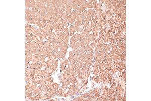 Immunohistochemistry of paraffin-embedded Rat heart using FRMD6 antibody (ABIN6132194, ABIN6140773, ABIN6140774 and ABIN6225347) at dilution of 1:100 (40x lens).
