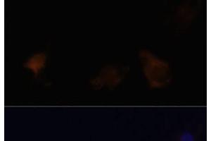 Immunofluorescence analysis of C6 cells using ZYX Polyclonal Antibody at dilution of 1:100.