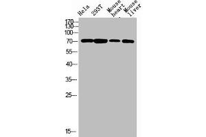 Western blot analysis of varias lysis using F13B antibody. (F13B 抗体  (Internal Region))