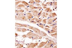 Immunohistochemical analysis of paraffin-embedded H. (PINK1 抗体)