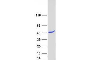 Western Blotting (WB) image for Paraneoplastic Antigen MA1 (PNMA1) protein (Myc-DYKDDDDK Tag) (ABIN2729236)