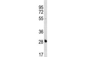 RBPMS antibody western blot analysis in NCI-H460 lysate. (RBPMS 抗体  (AA 166-193))