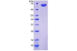 SDS-PAGE (SDS) image for Deiodinase, Iodothyronine, Type II (DIO2) protein (ABIN3009143)