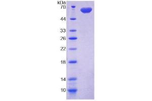 SDS-PAGE analysis of Rat DIO2 Protein. (DIO2 蛋白)