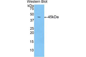 Western blot analysis of the recombinant protein. (LCN8 抗体  (AA 25-176))