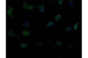 Immunofluorescence staining of U251 cells with(ABIN7176749)at 1:90, counter-stained with DAPI.