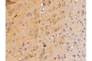 Siglec 7 Antibody at 1/100 staining Rat brain tissue by IHC-P. (SIGLEC7 抗体  (C-Term))