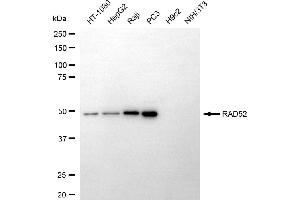 Western blotting analysis using RAD52 antibody (ABIN7800121). (Recombinant RAD52 抗体)