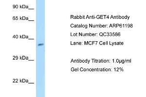 Western Blotting (WB) image for anti-Chromosome 7 Open Reading Frame 20 (C7orf20) (N-Term) antibody (ABIN2788715) (Chromosome 7 Open Reading Frame 20 (C7orf20) (N-Term) 抗体)