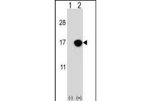 Western blot analysis of CDKN2B (arrow) using rabbit polyclonal CDKN2B Antibody (C-term) (ABIN656561 and ABIN2845822).