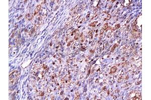 Immunohistochemistry (Paraffin-embedded Sections) (IHC (p)) image for anti-Cyclin-Dependent Kinase 2 (CDK2) (AA 1-100) antibody (ABIN2172819) (CDK2 抗体  (AA 1-100))