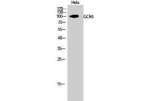 Western Blotting (WB) image for anti-K(lysine) Acetyltransferase 2A (KAT2A) (C-Term) antibody (ABIN3175241) (KAT2A 抗体  (C-Term))