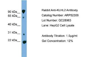 WB Suggested Anti-KLHL2  Antibody Titration: 0.