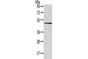 Gel: 8 % SDS-PAGE,Lysate: 40 μg,Primary antibody: ABIN7131404(TMPRSS4 Antibody) at dilution 1/500 dilution,Secondary antibody: Goat anti rabbit IgG at 1/8000 dilution,Exposure time: 3 minutes (TMPRSS4 抗体)