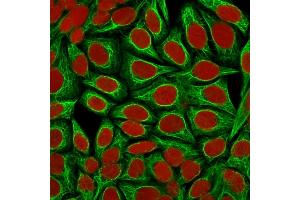 Confocal immunofluorescence image of HeLa cells using Cytokeratin 18 Mouse Monoclonal Antibody (KRT18/1190).