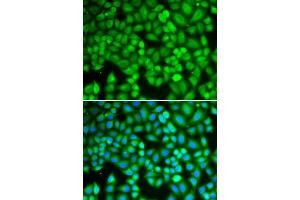 Immunofluorescence analysis of U2OS cells using WAS antibody. (WASP 抗体  (AA 60-250))